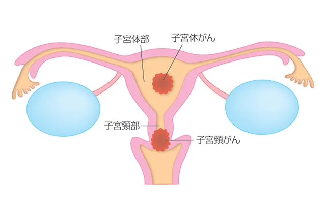 子宮内のイメージ画像